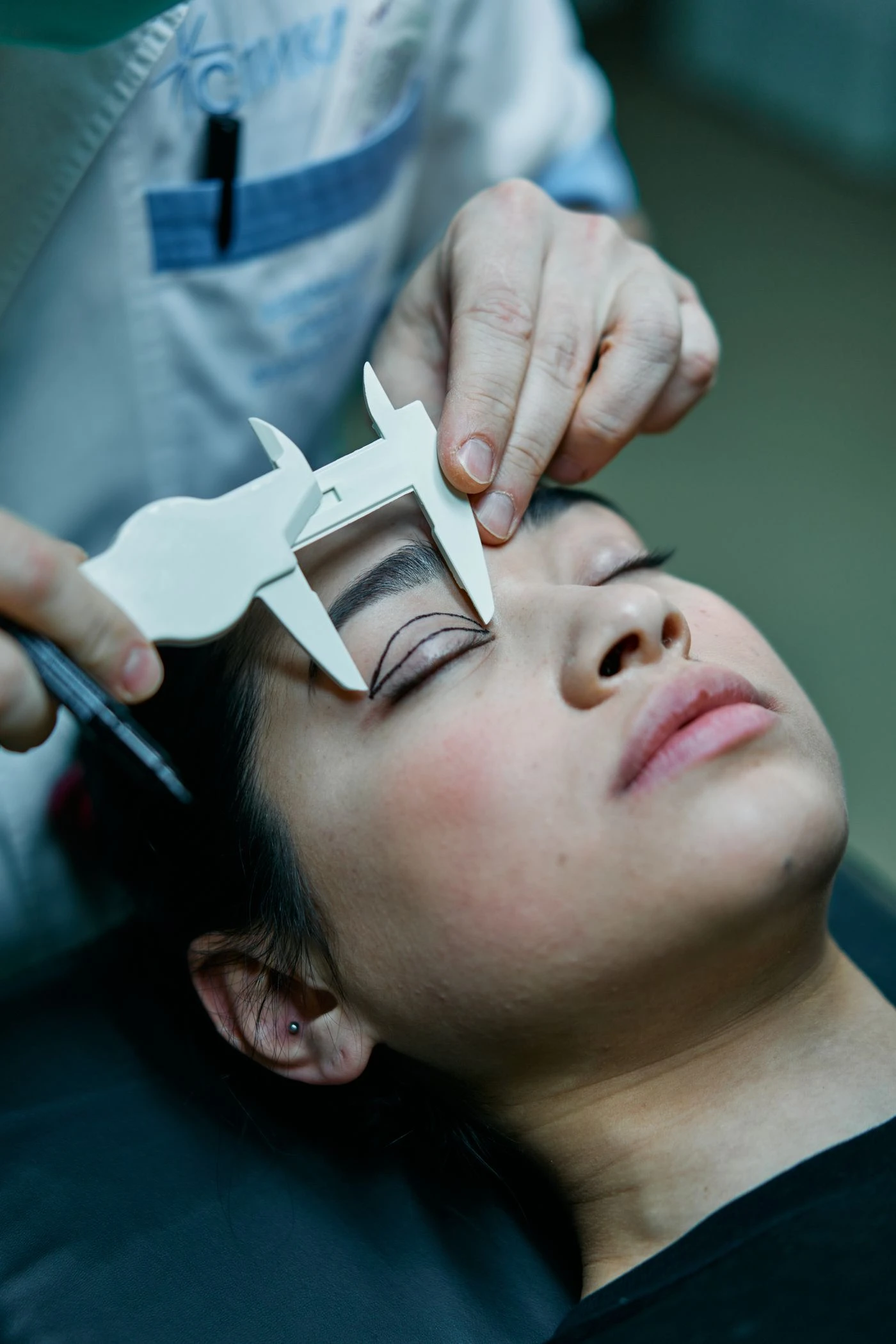 LASIK SURGERY