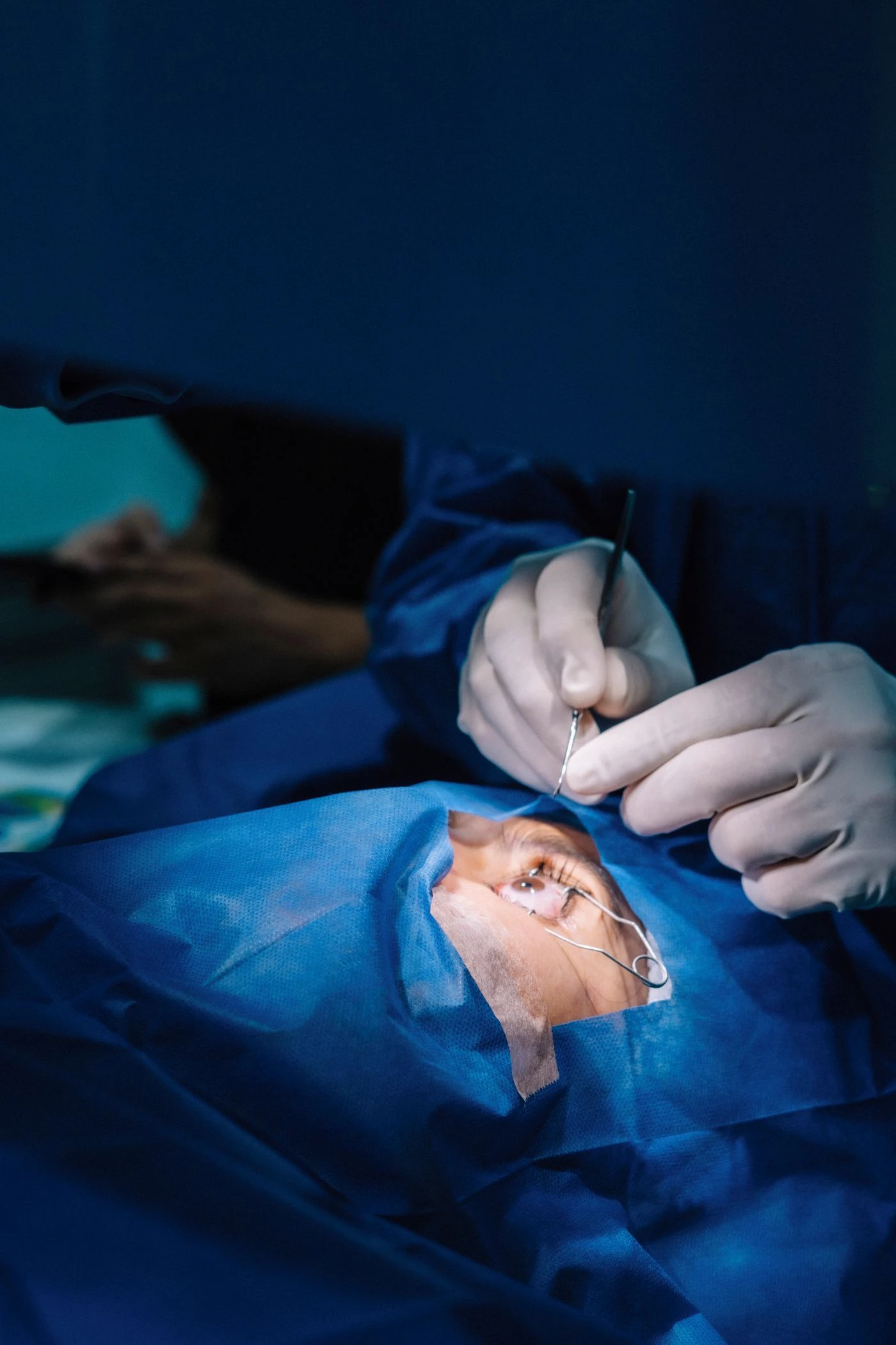 SMILE SURGERY