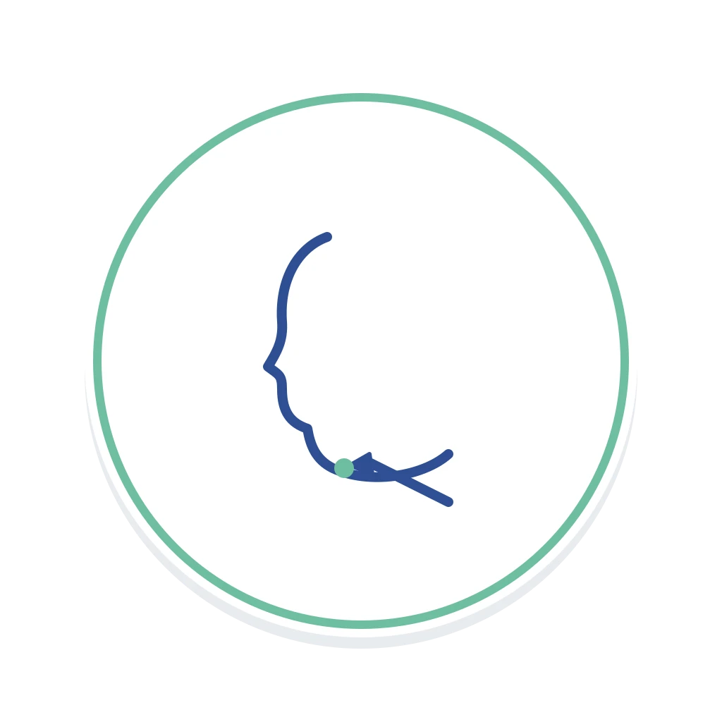 Neck Liposuction (Submental Lipo)