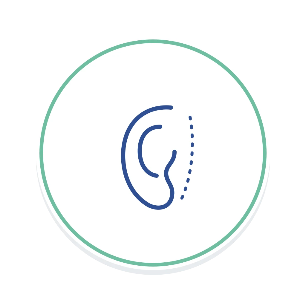 Otoplasty (Ear Surgery)